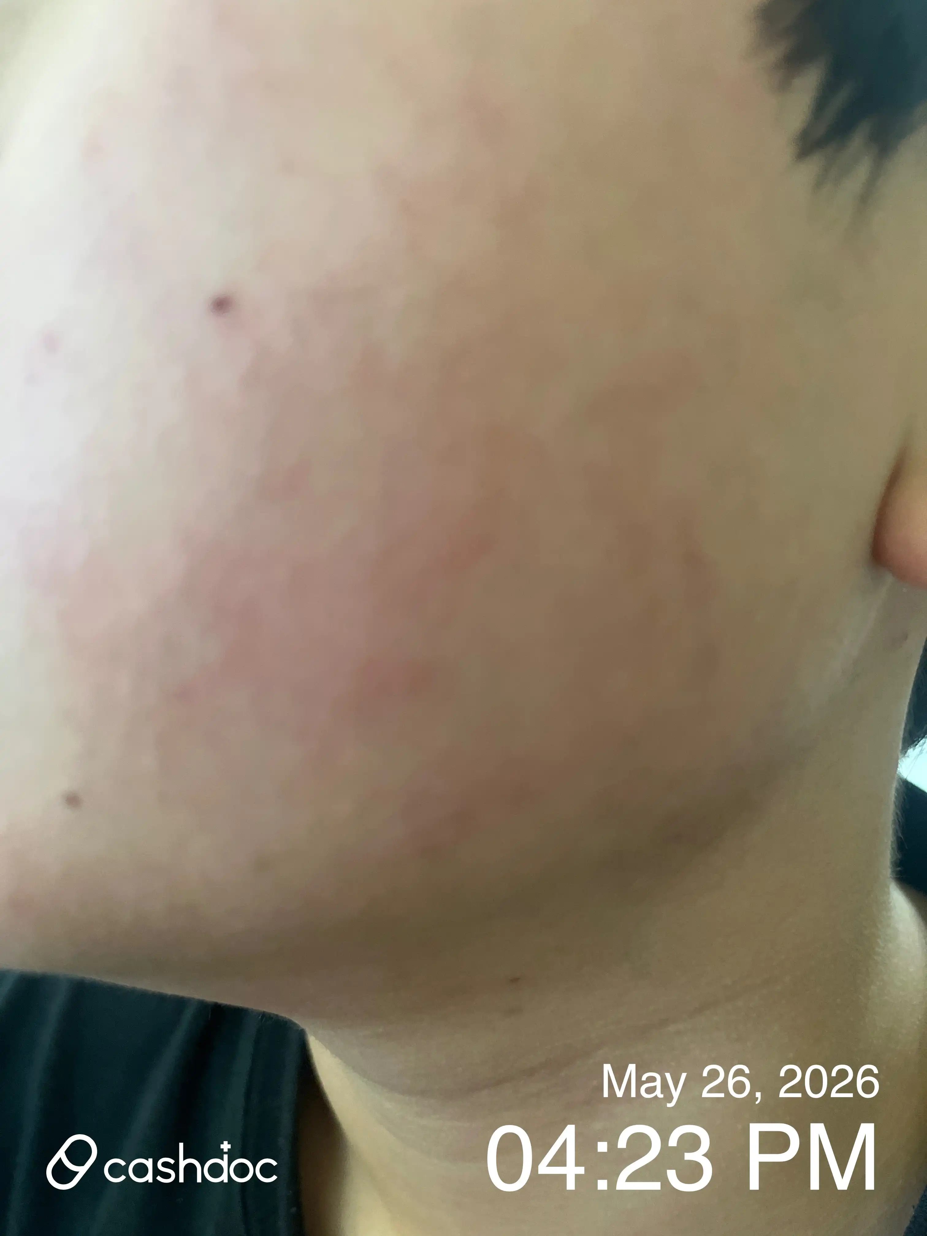 Review photo