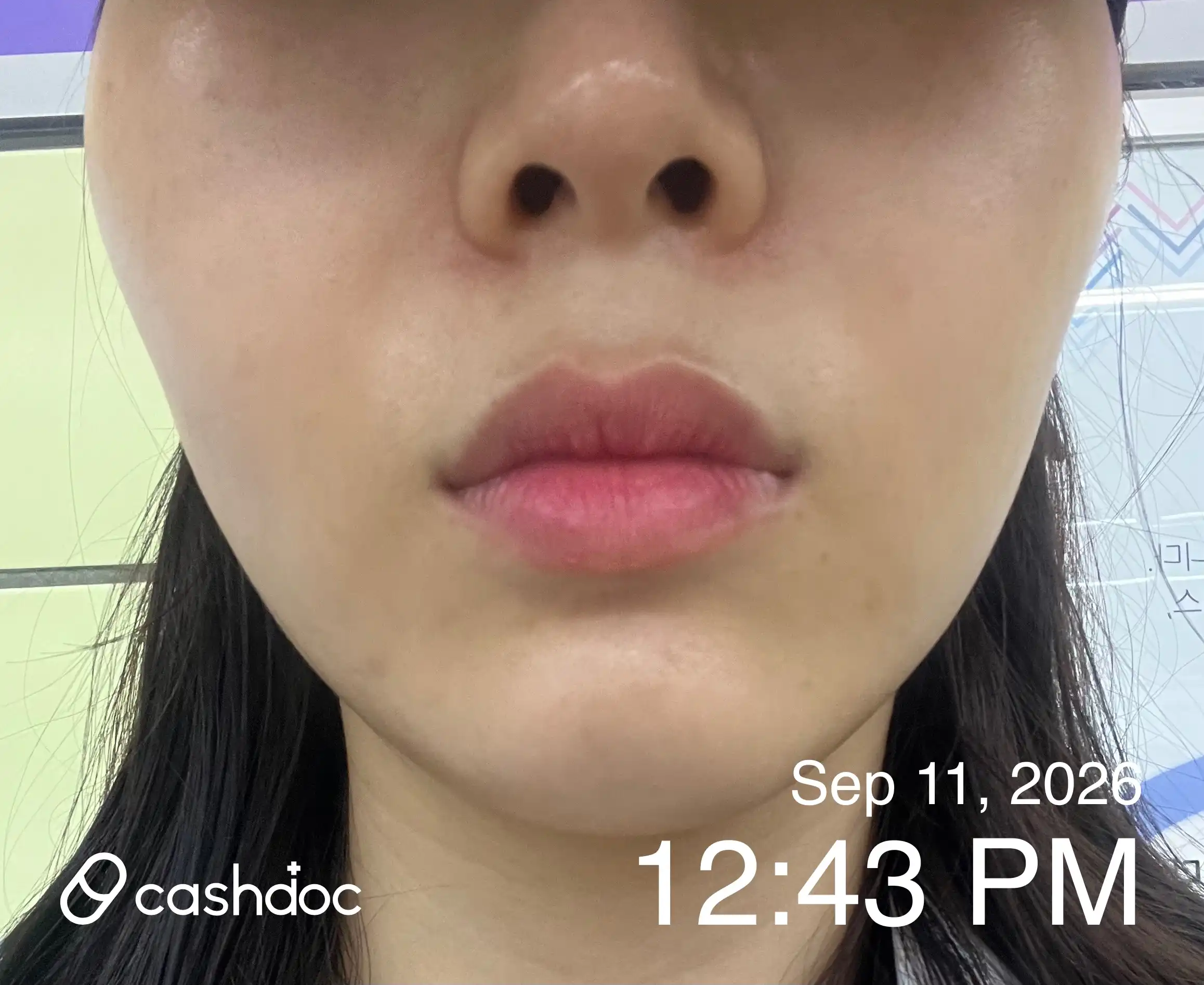 Review photo