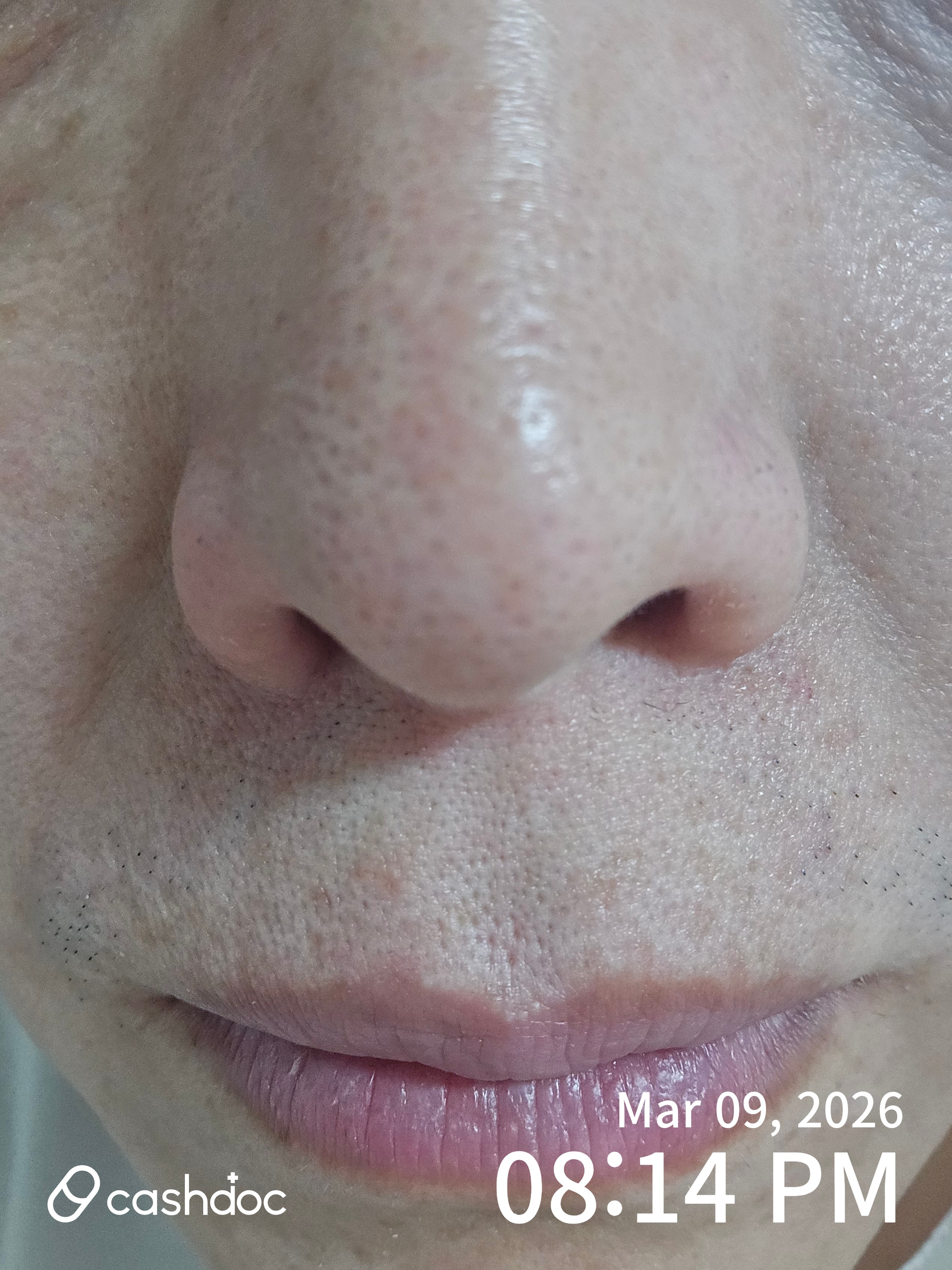 부평구 뱅뱅이비인후과, 찬바람 코 통증 신속 해결!