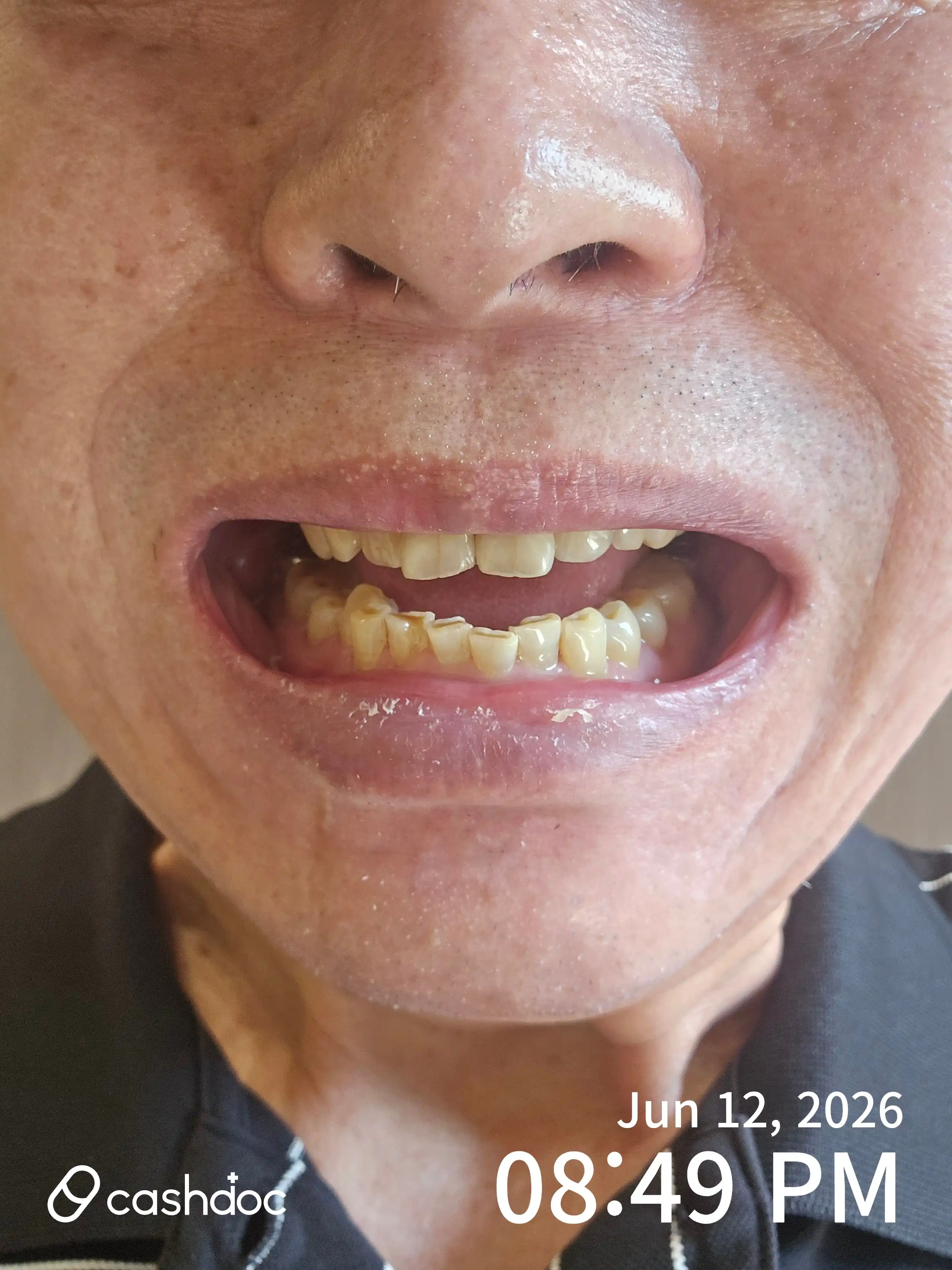 Review photo