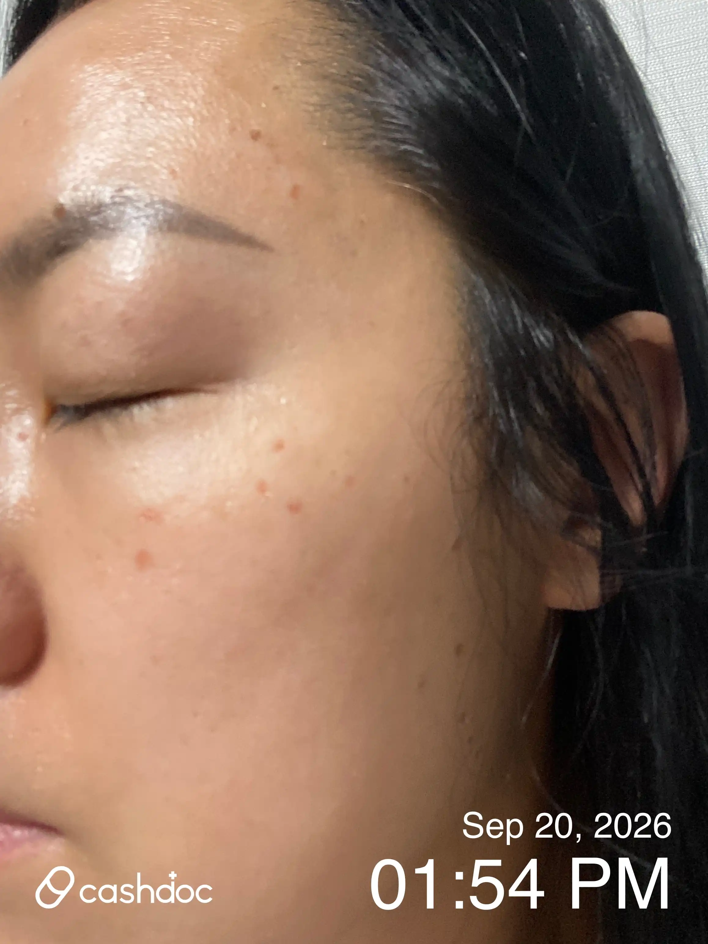 Review photo
