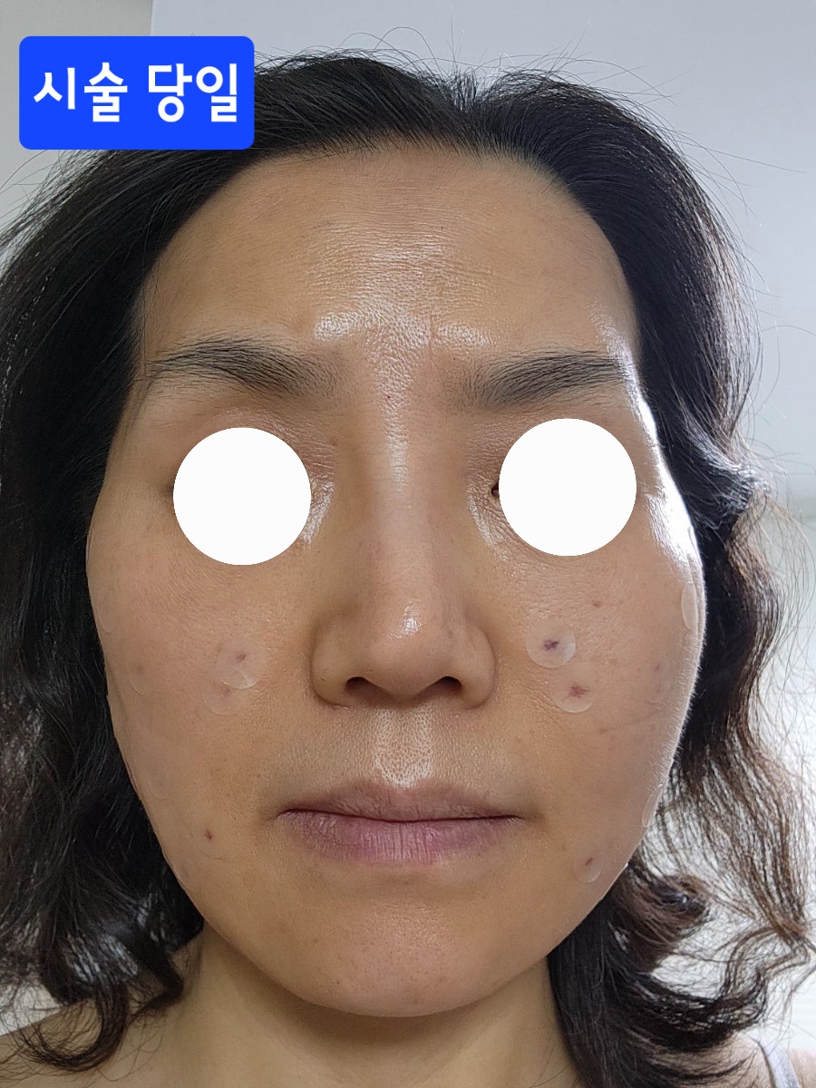 レビュー写真