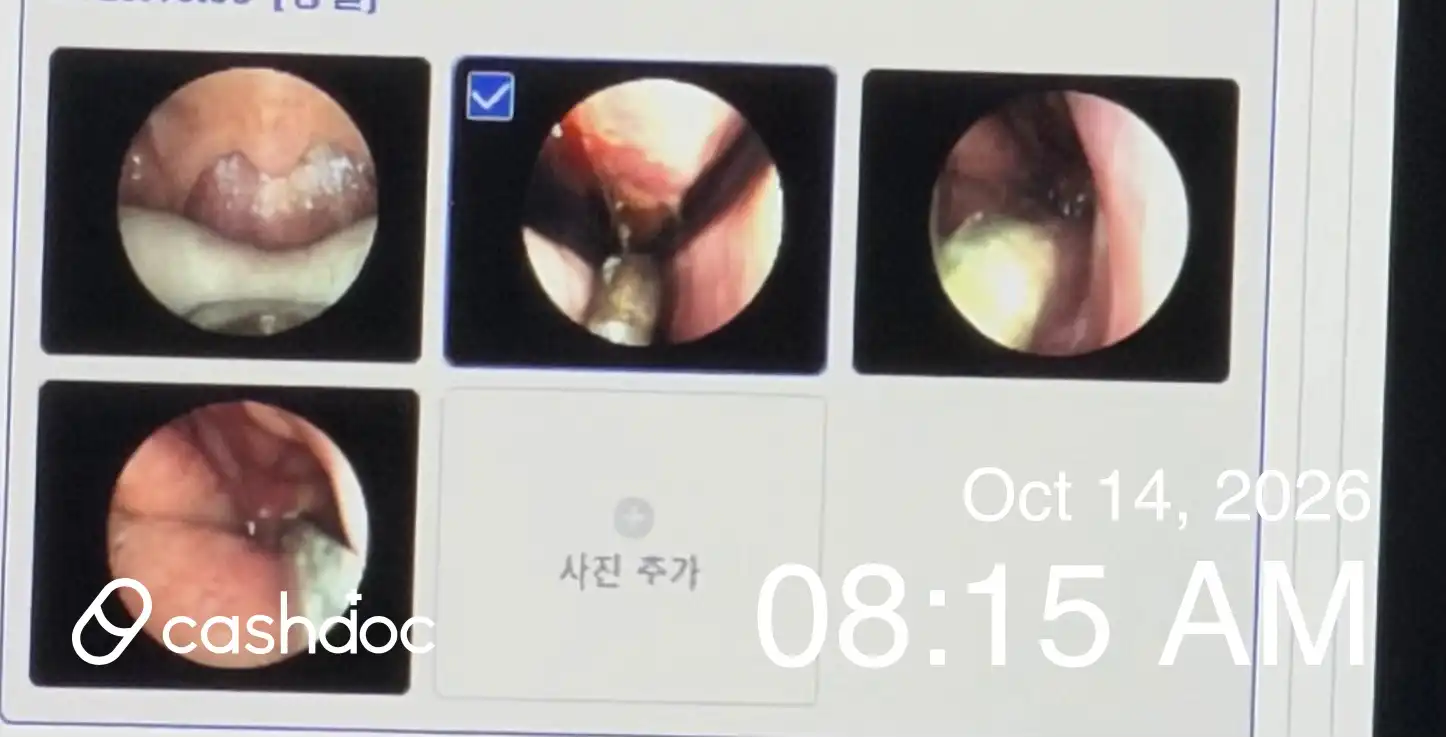 리뷰 사진