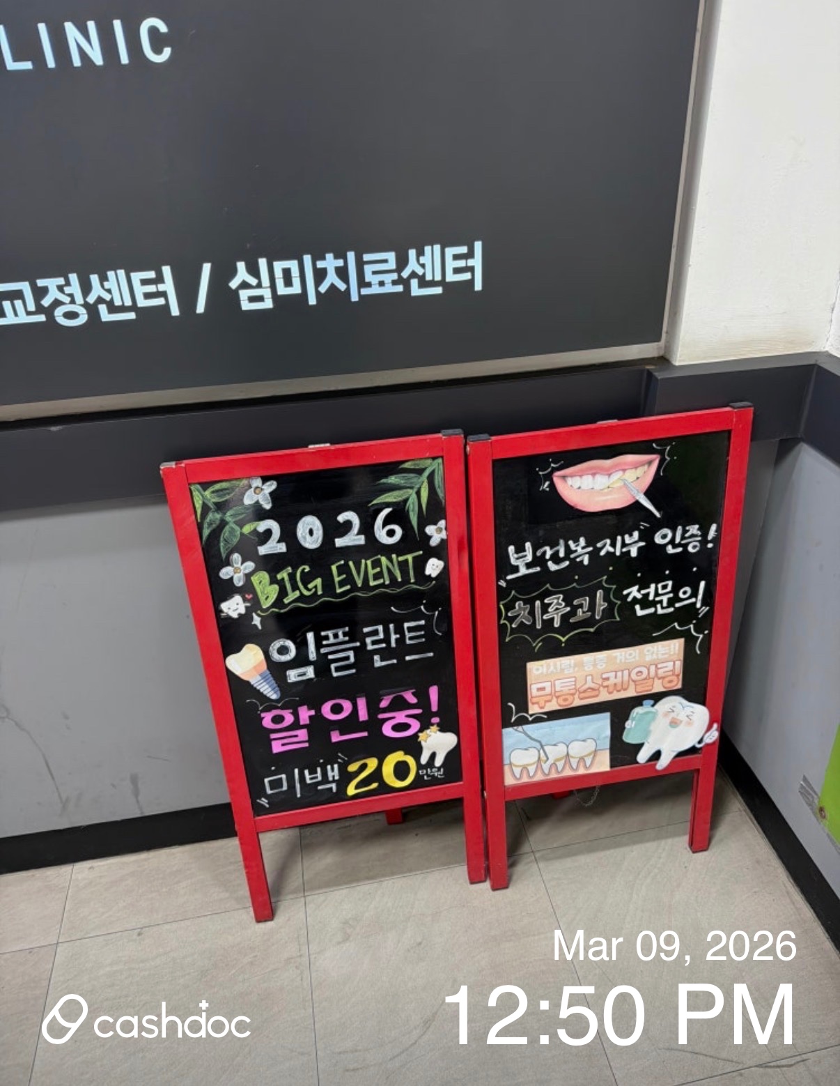 하남시 서울온정치과의원에서 친절하게 임플란트 수술 경험