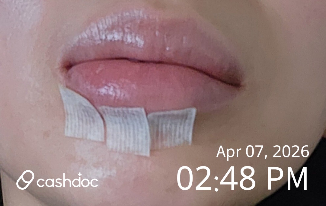 수원시 미세성형외과의원에서 주말 응급수술, 만족스러워!