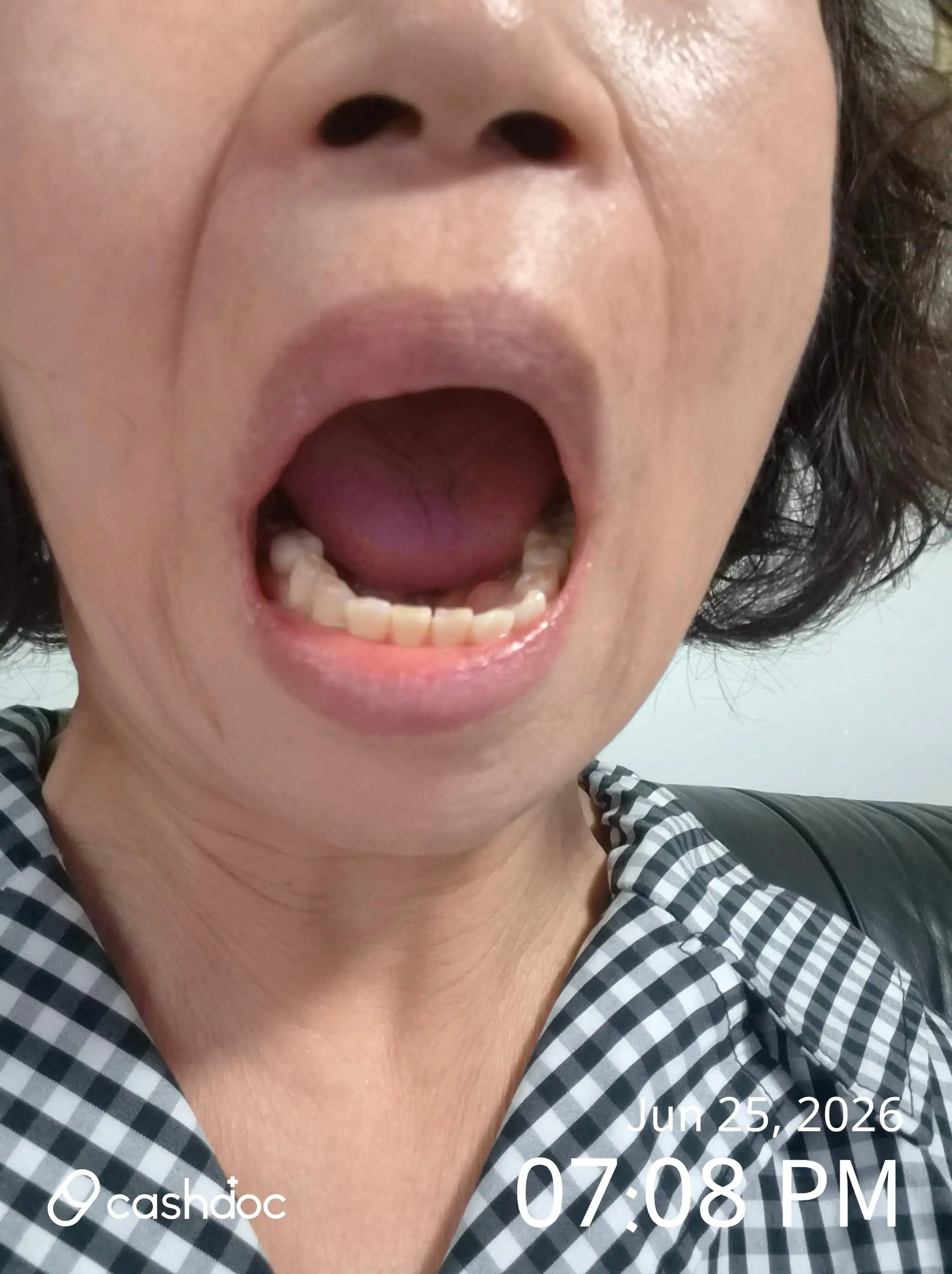 리뷰 사진