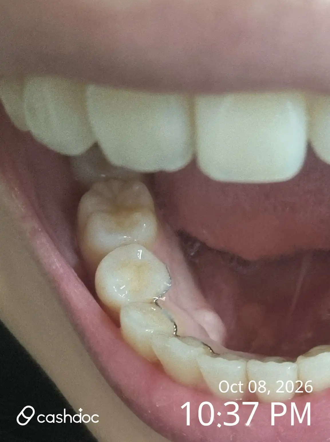 White E Dental Clinic Deokcheon Branch review photo
