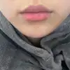 後