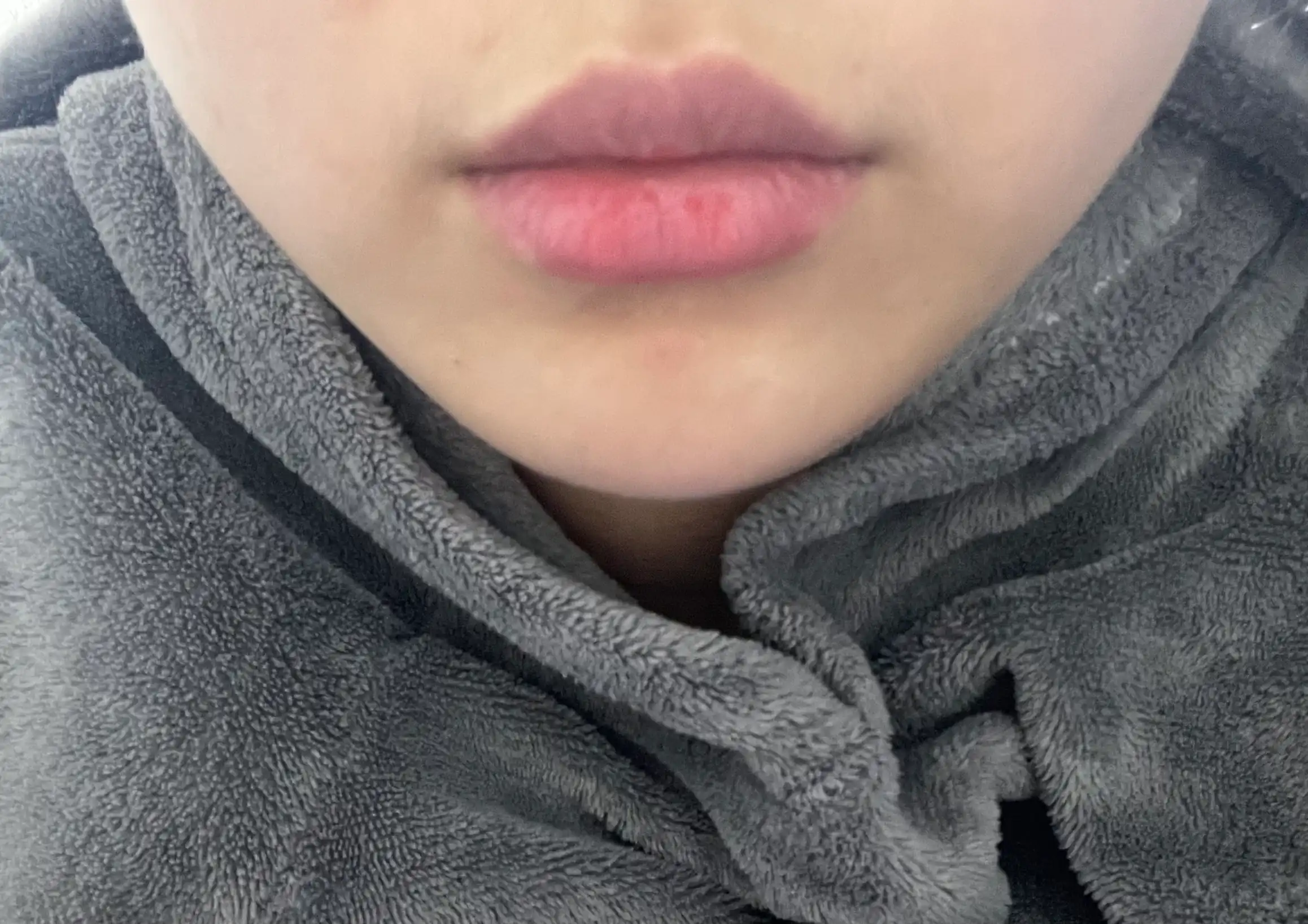 후
