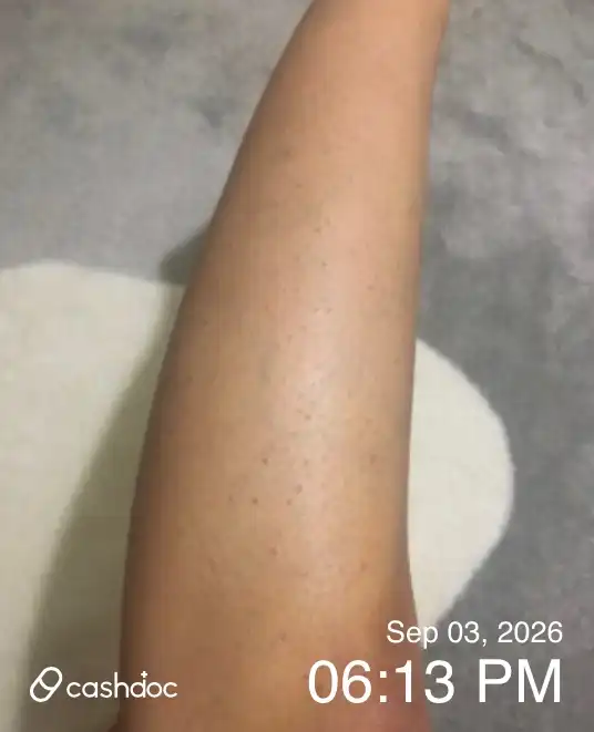 Review photo