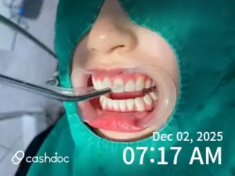 리뷰 사진