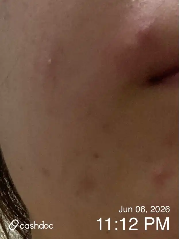 Review photo