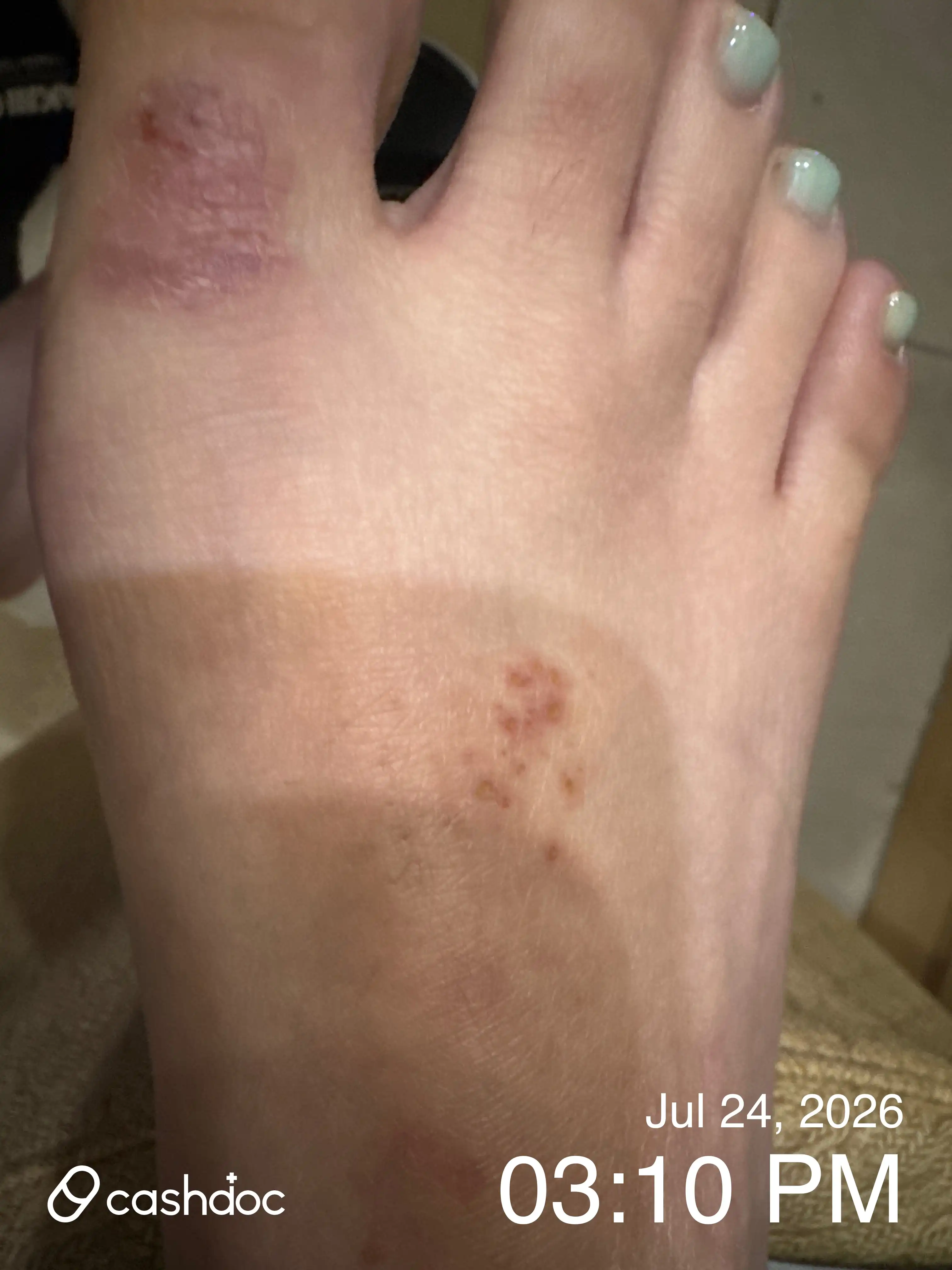 评价照片