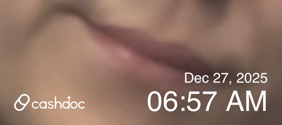 은평구 메이퓨어 연신내점, 수염 레이저 제모 후기