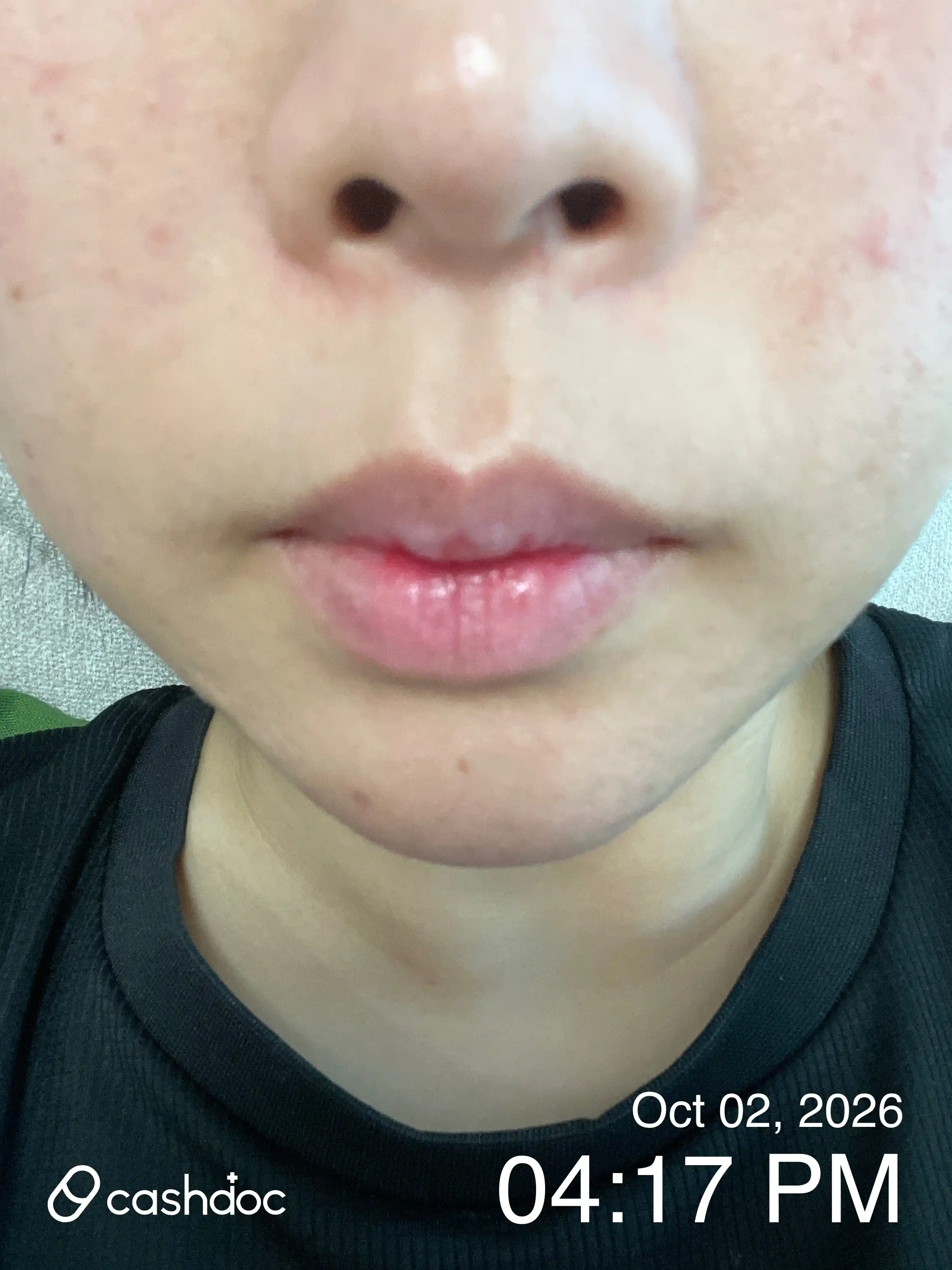 Review photo