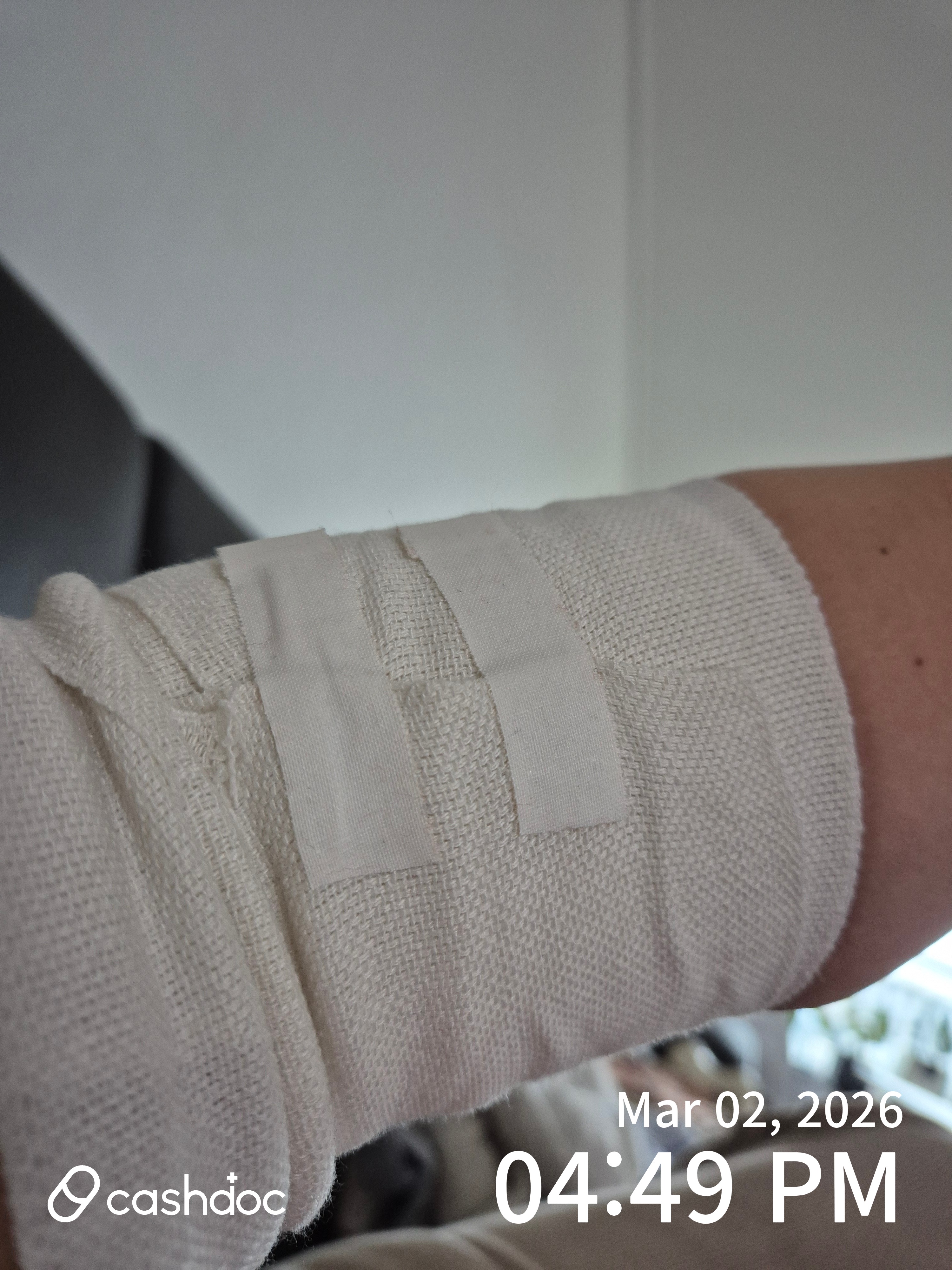 청주 백승일의참정형외과에서 받은 프롤로와 PRP주사 경험