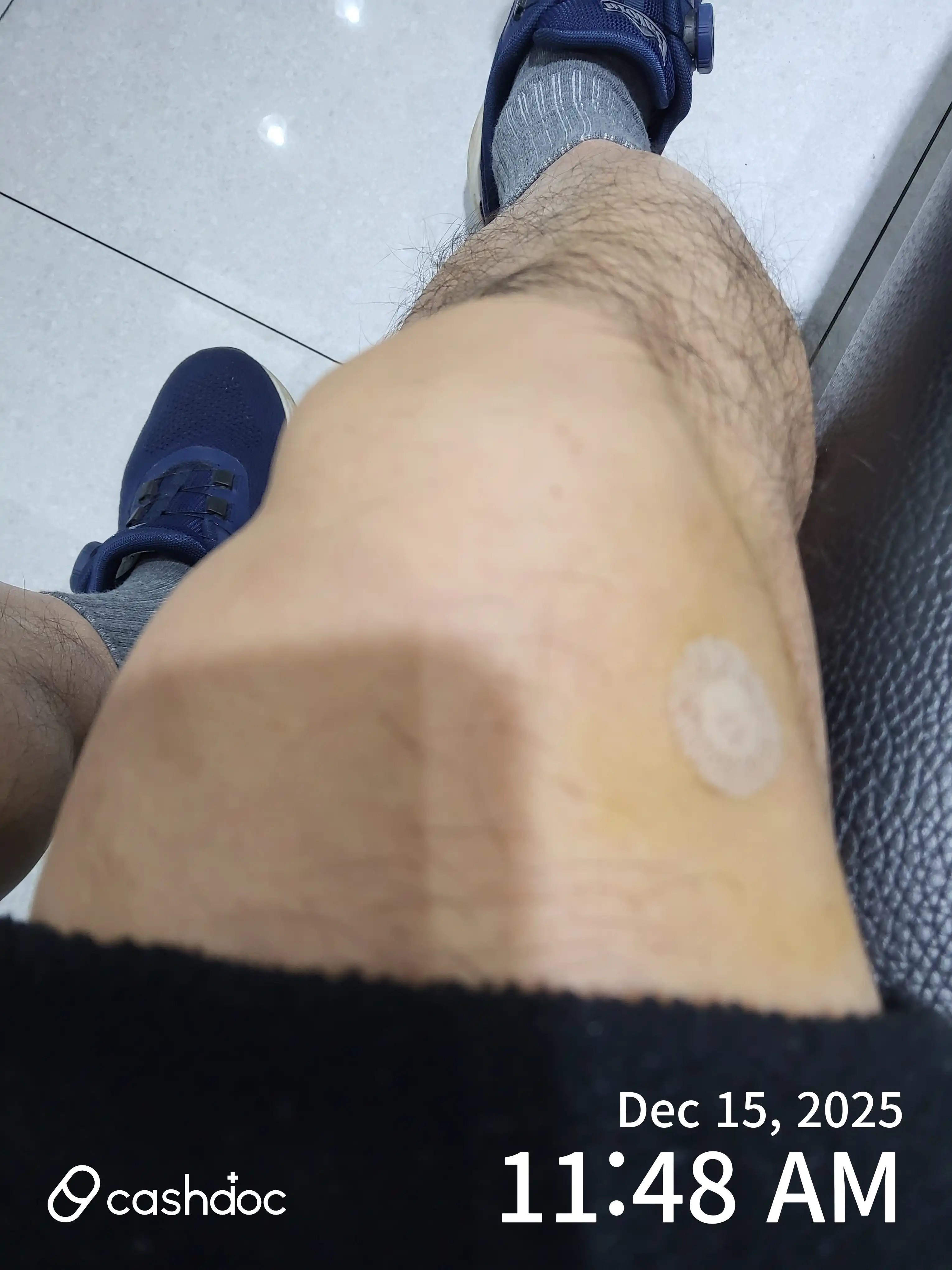 评价照片