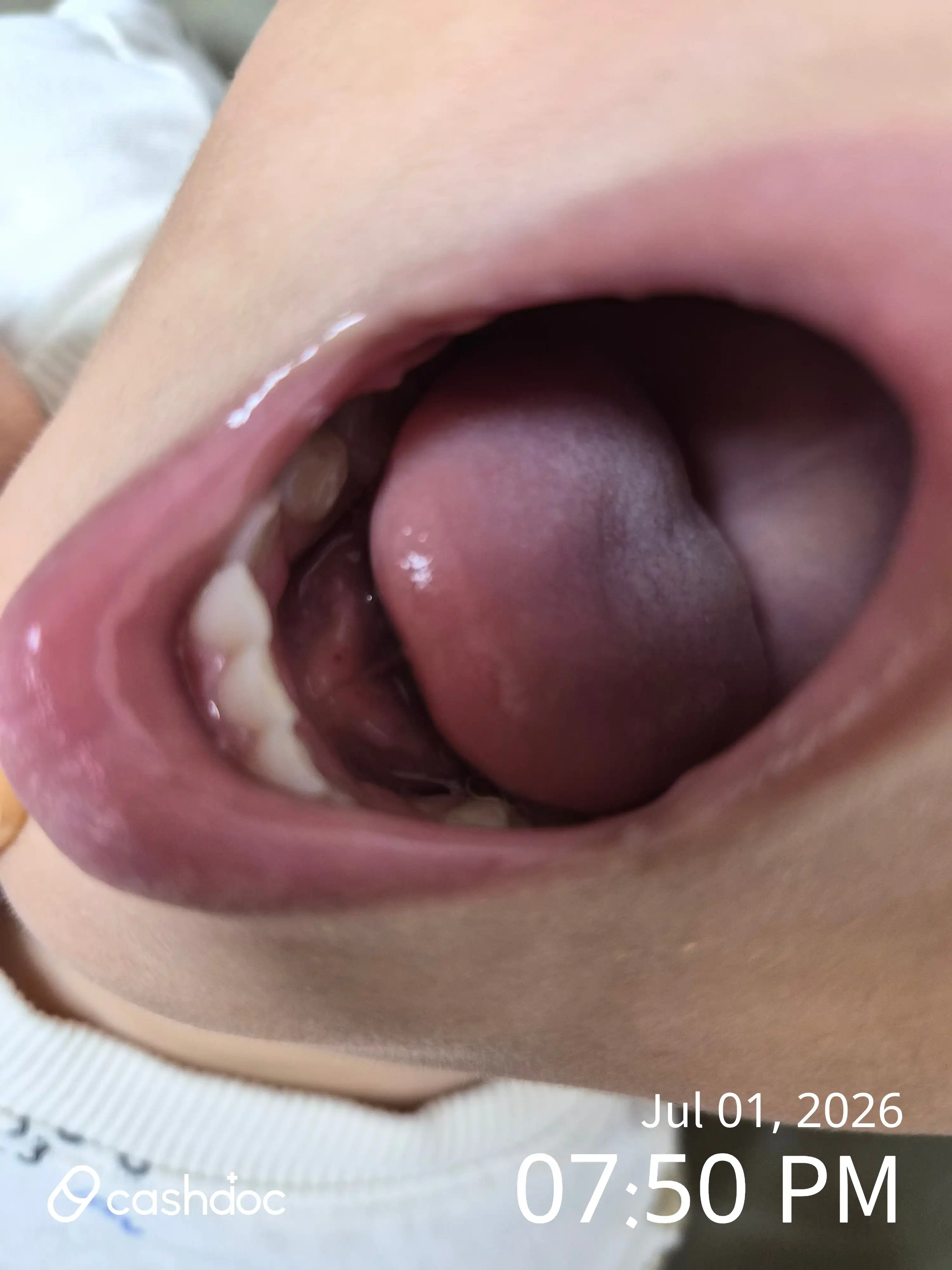 Review photo