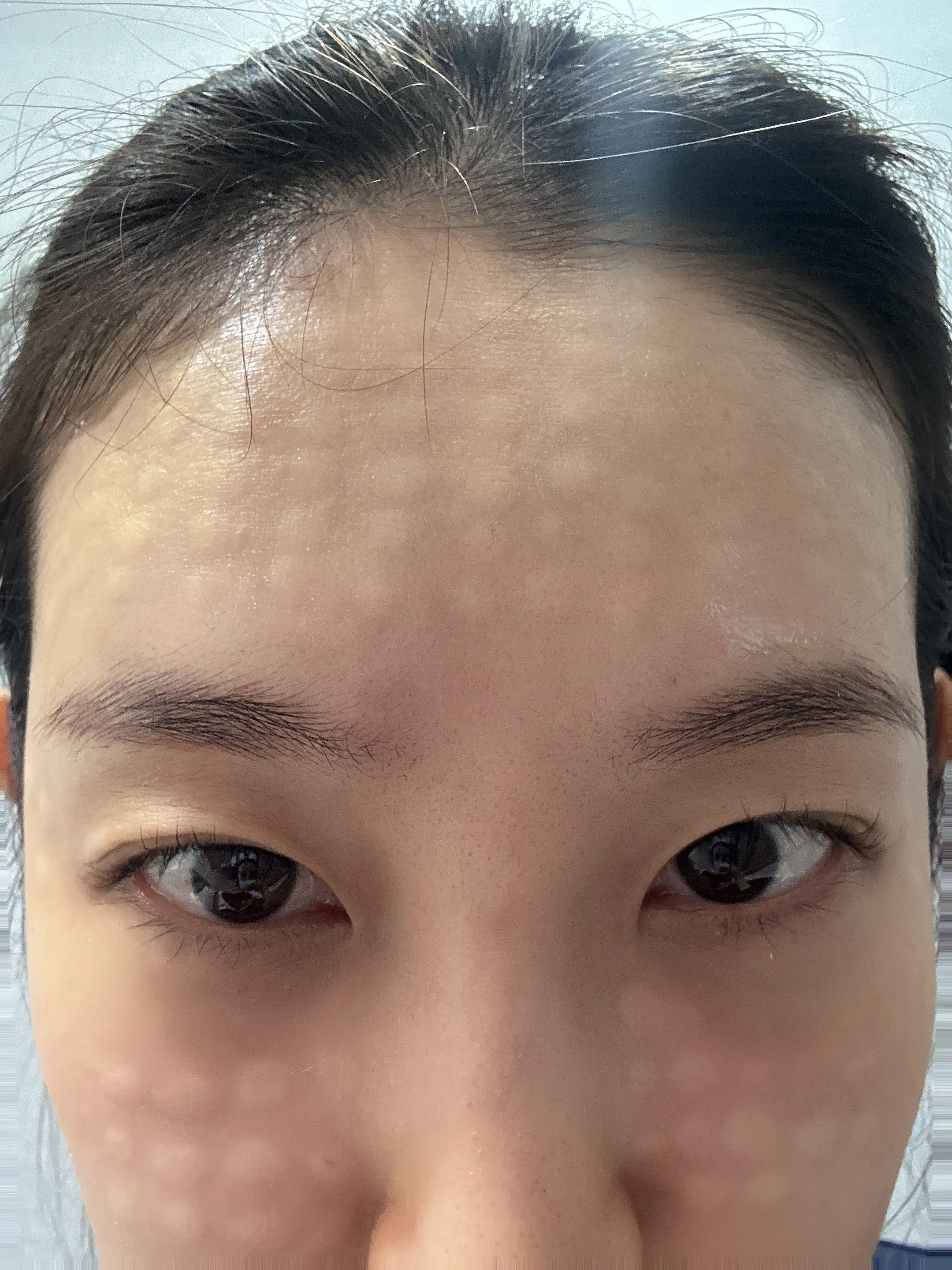 후