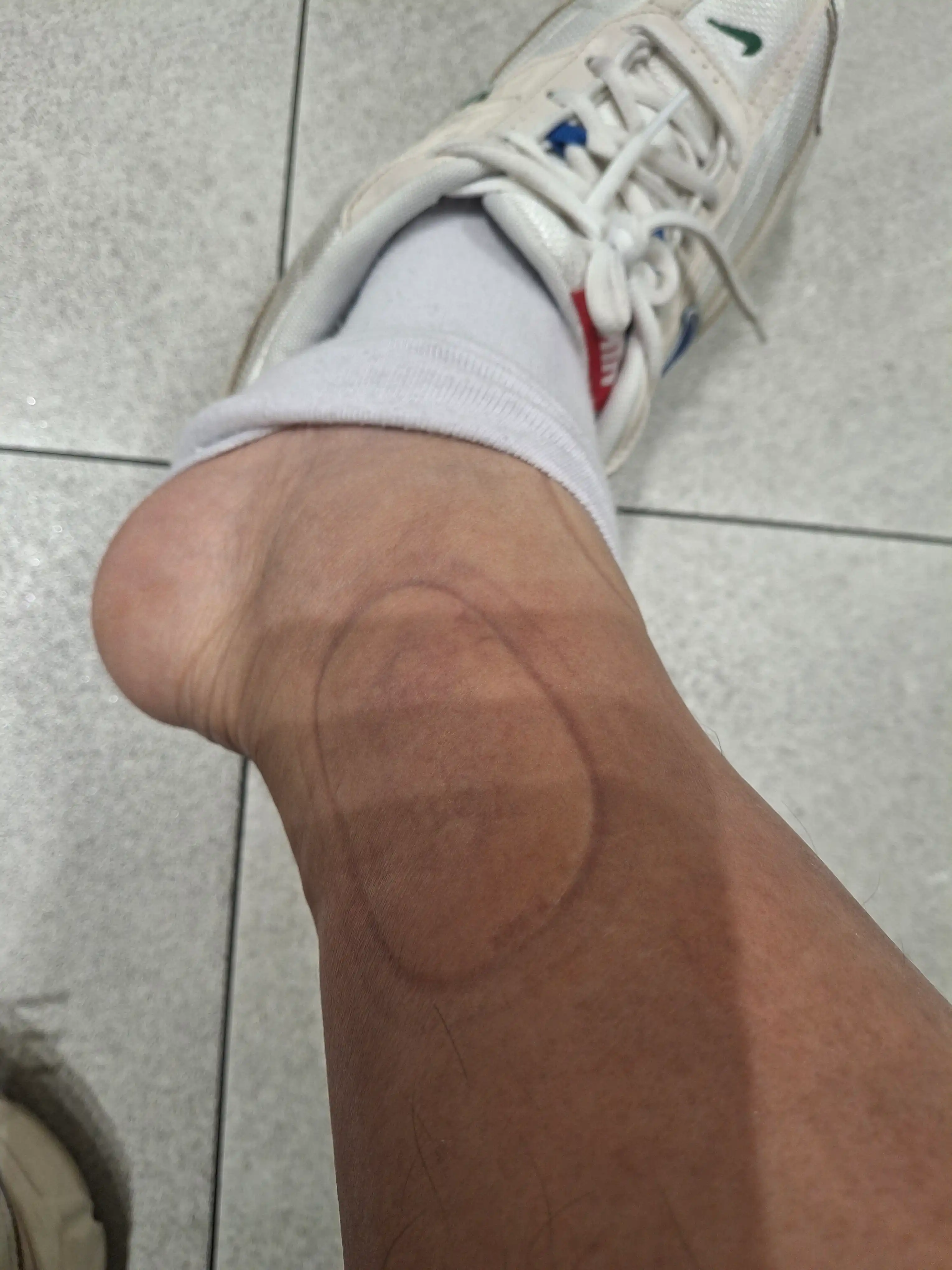 评价照片
