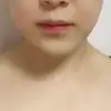 前