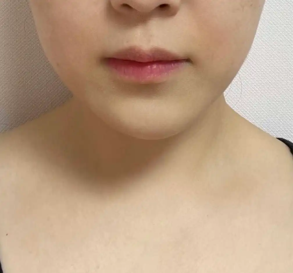 전