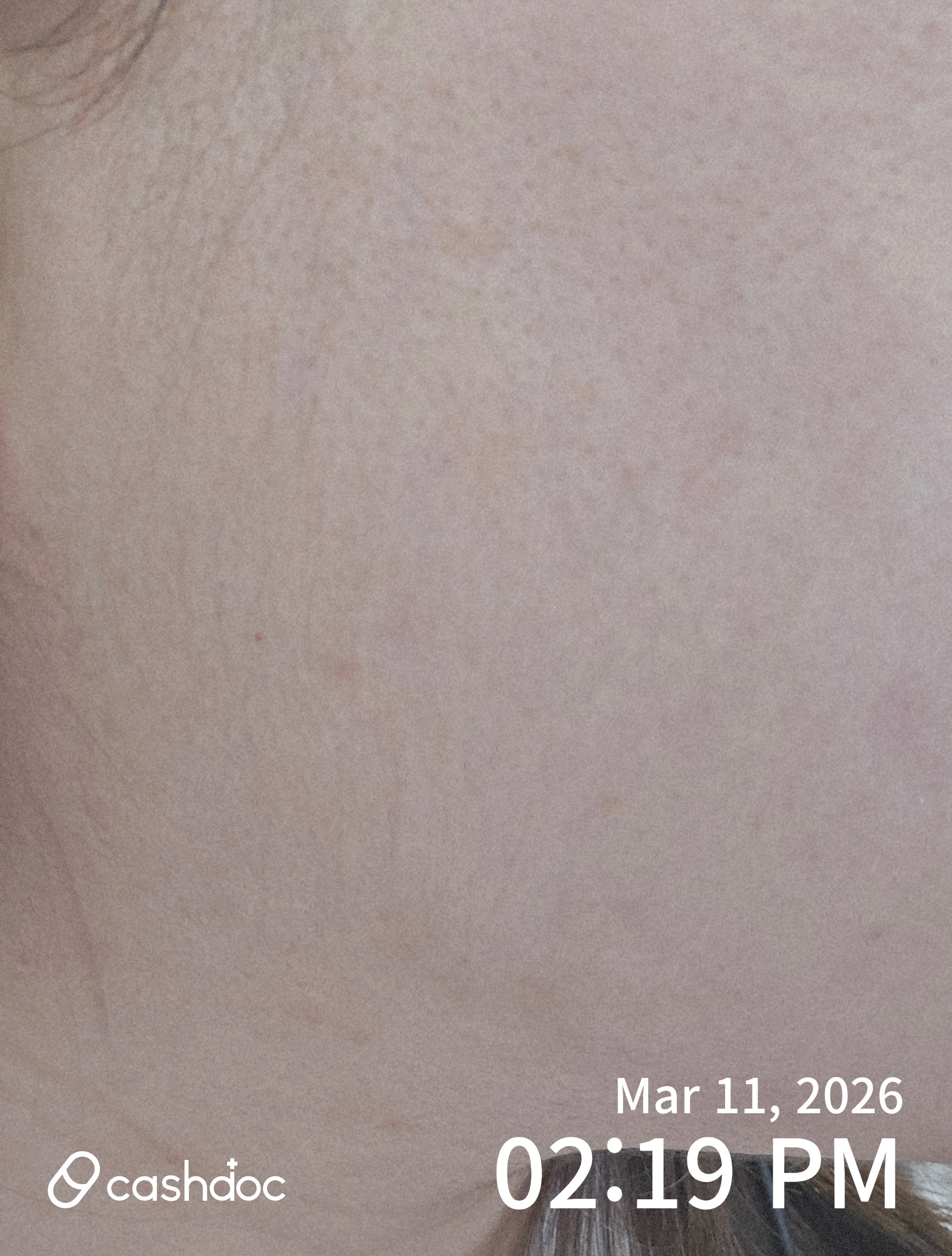 영등포구 메이퓨어의원에서 받은 친절한 직원 응대와 보톡스 시술 경험