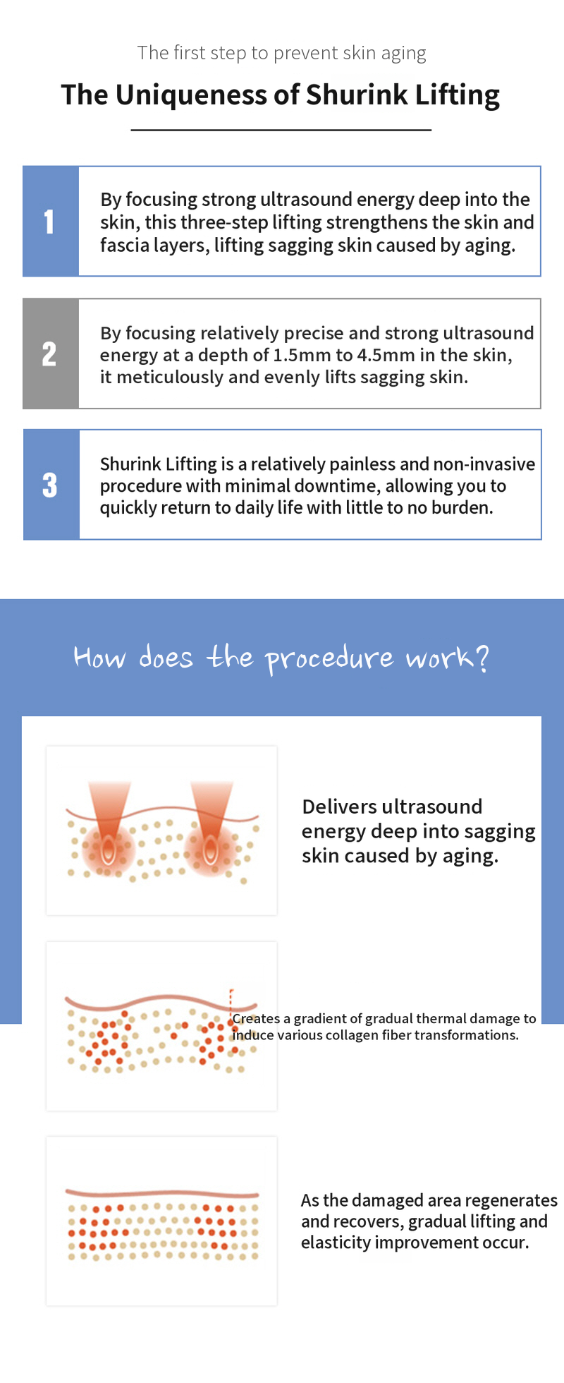 Otherworldly Elasticity, Shrink