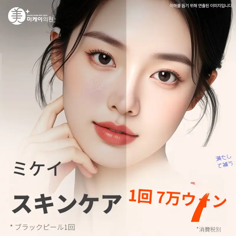 ミケイ 皮膚管理 _ブラックピール、水ボトックス