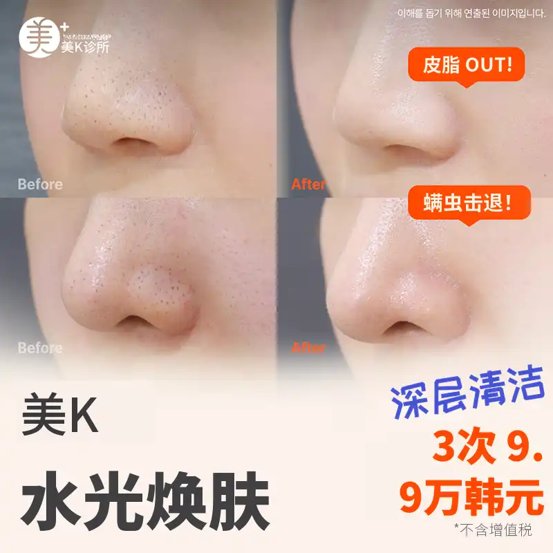 MiK角质和毛孔清洁_水疗