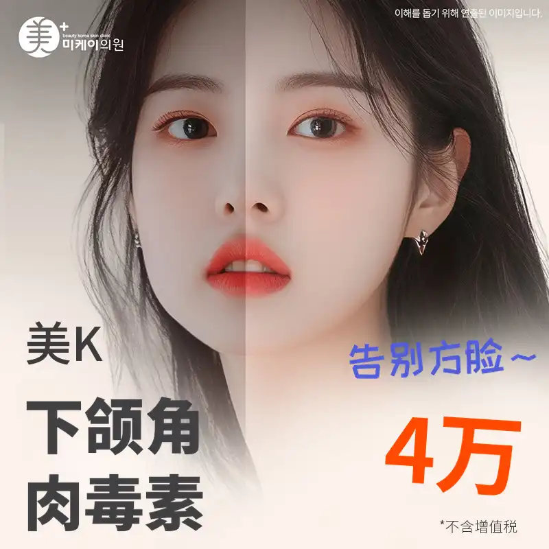 MiK方下巴肉毒素