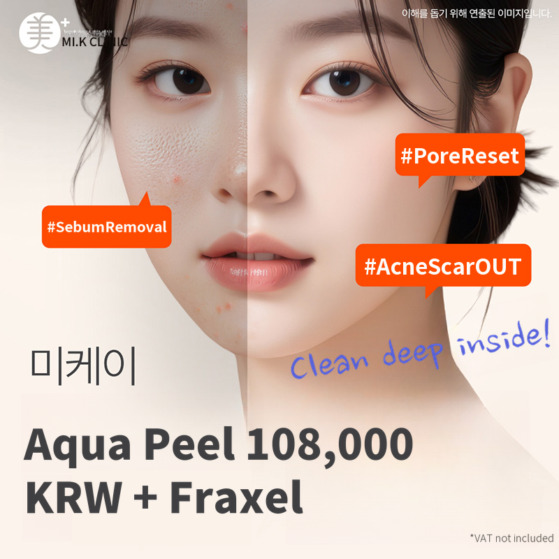 Mikey pore clear with Aqua peel + Fraxel