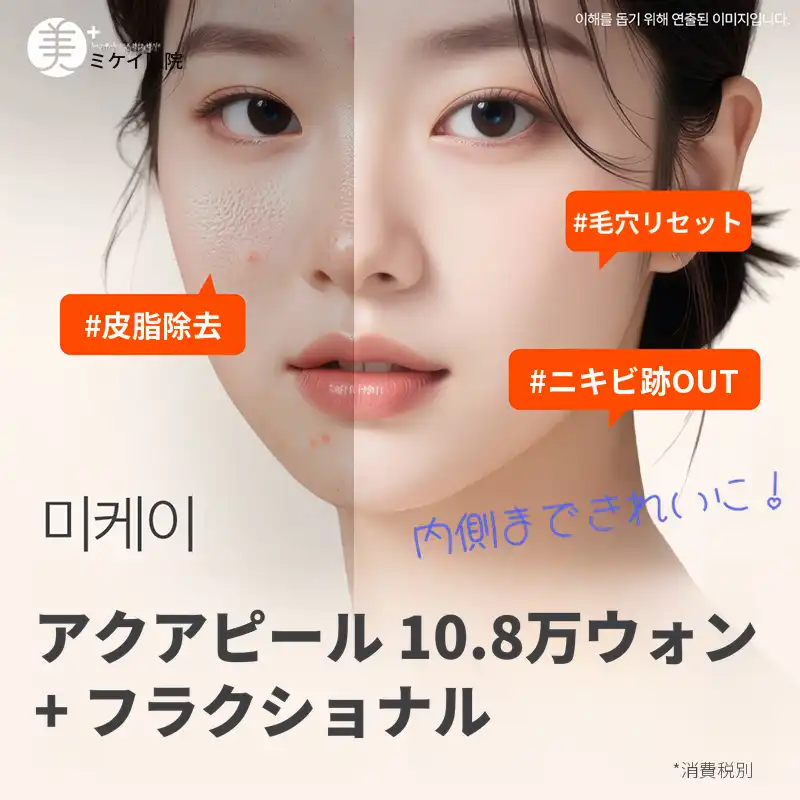 ミケイ毛穴クリア_アクアフィル+フラクセル