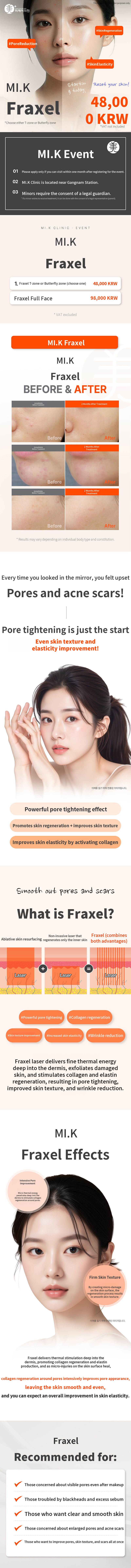 Mikey pore & acne scar improvement with Fraxel