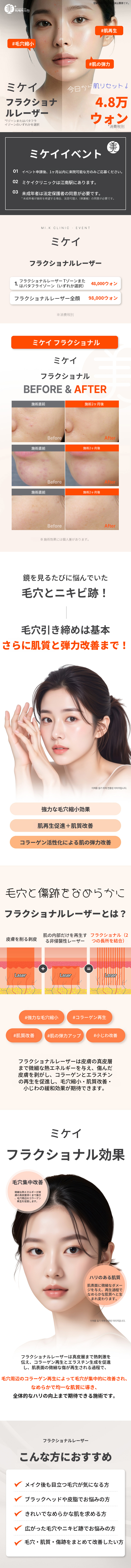 ミケイ毛穴&ニキビ跡改善_フラクセル