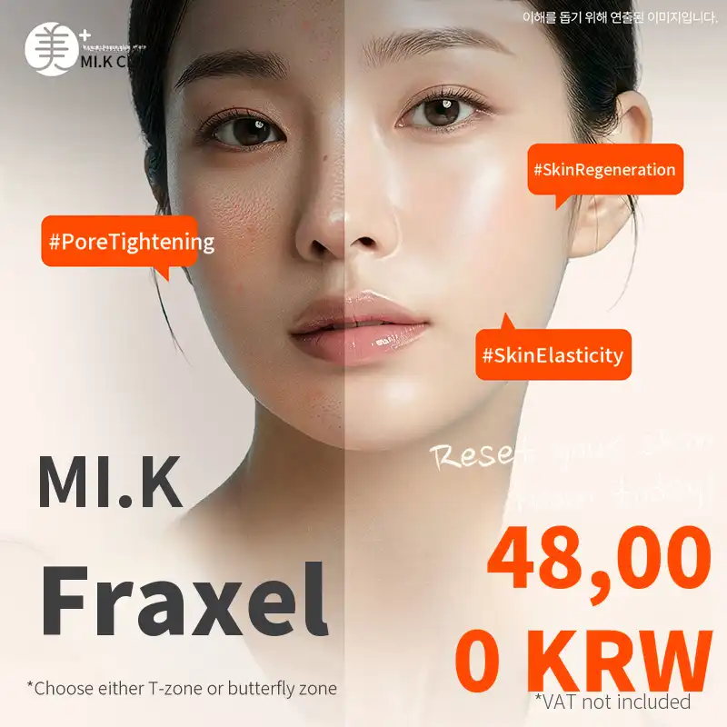 Mikey pore & acne scar improvement with Fraxel