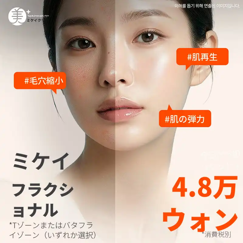 ミケイ毛穴&ニキビ跡改善_フラクセル