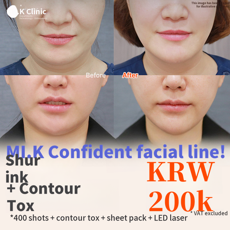 Mikay Elasticity Improvement_Shrink + Contour Tox
