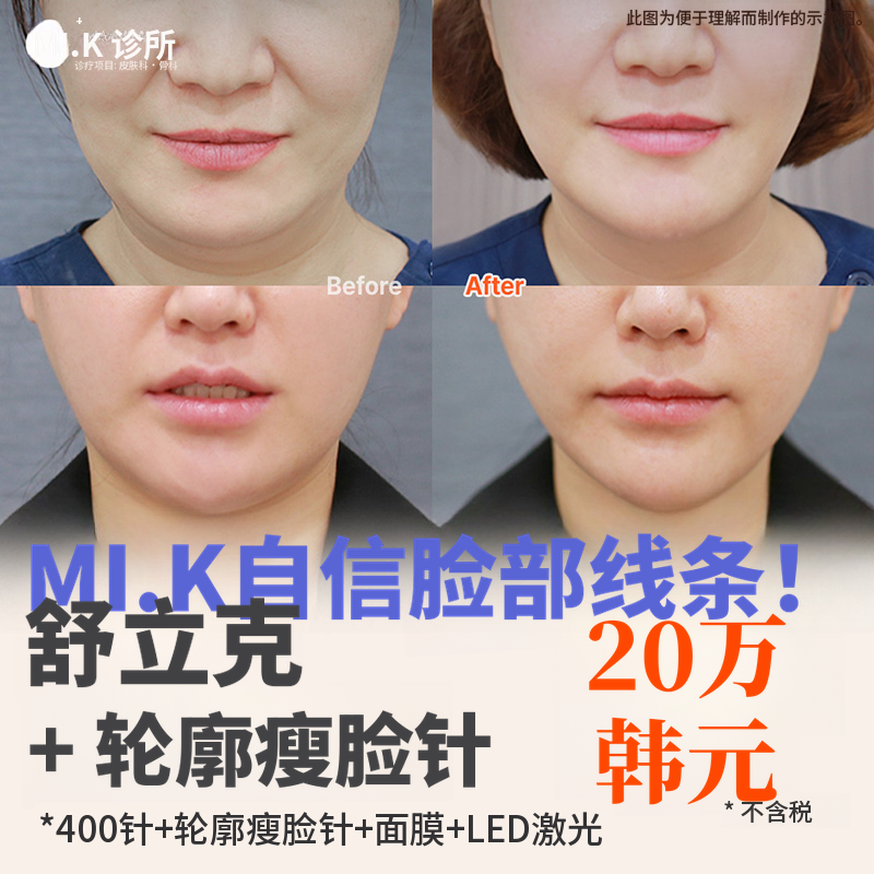 米凯弹力改善_收缩+轮廓毒素