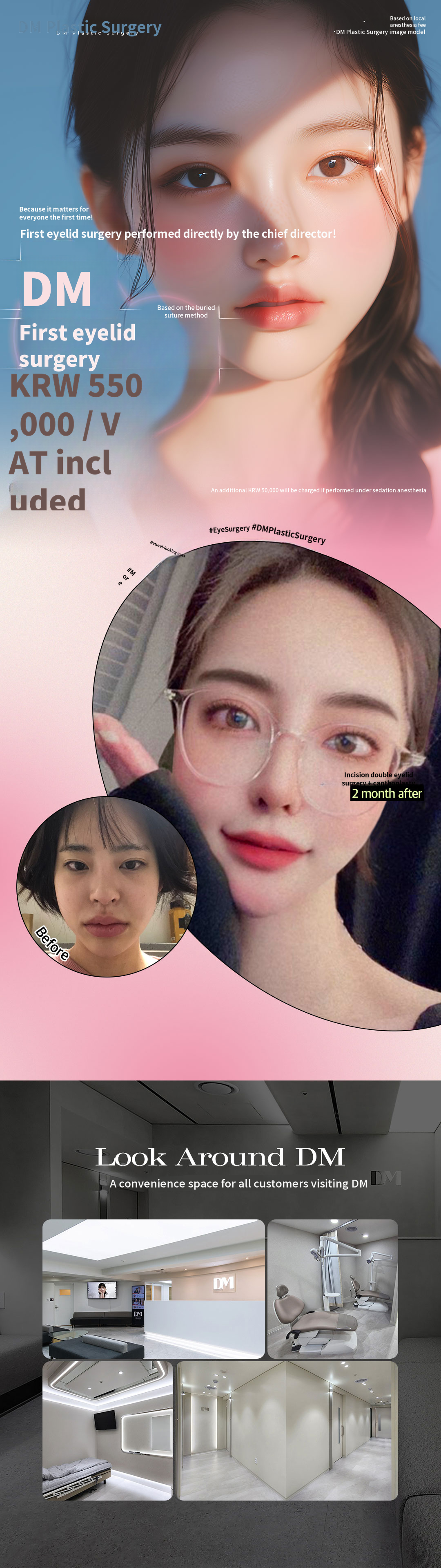 ♥DM♥ Double Eyelid