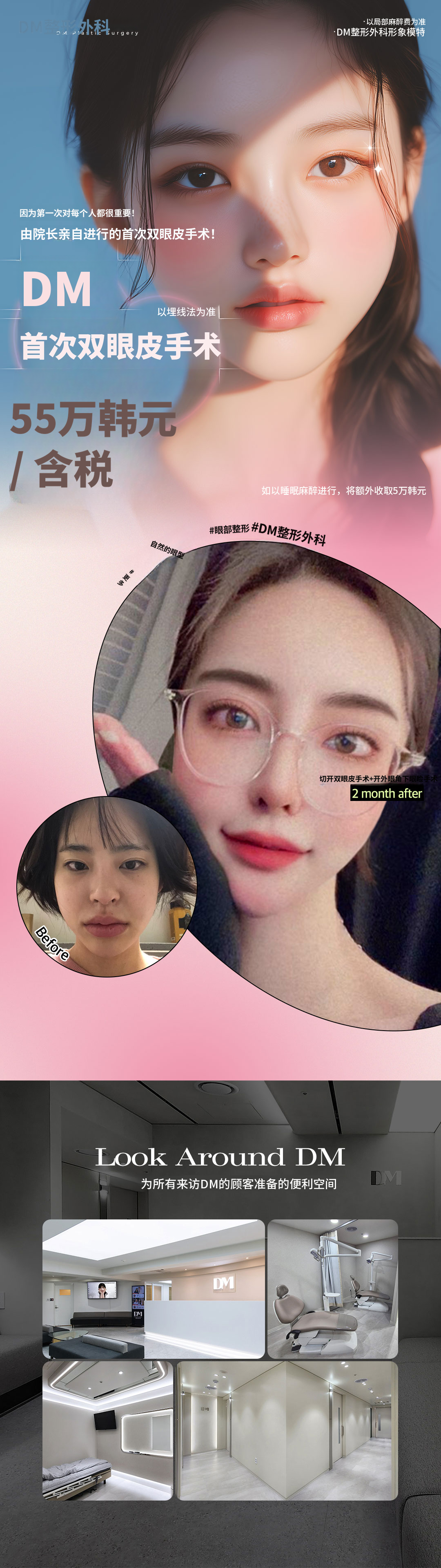 ♥迪恩♥ 双眼皮
