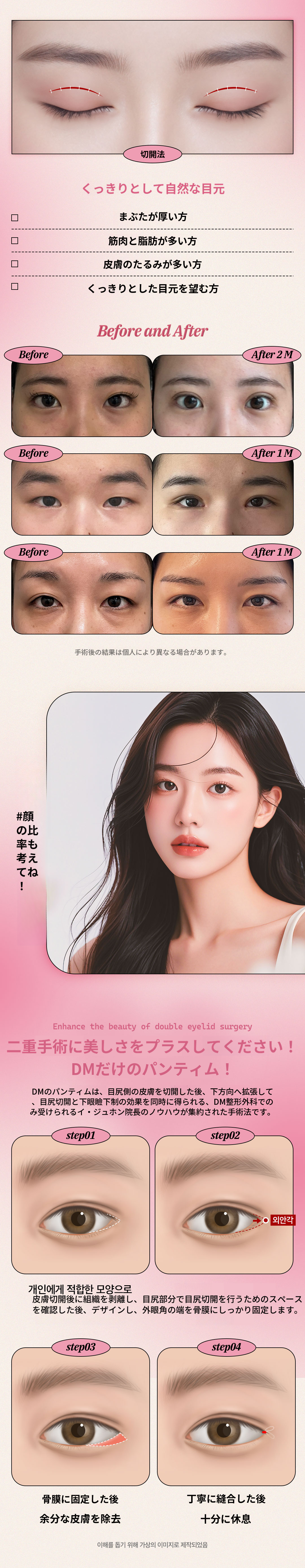 ♥DM♥ 二重まぶた