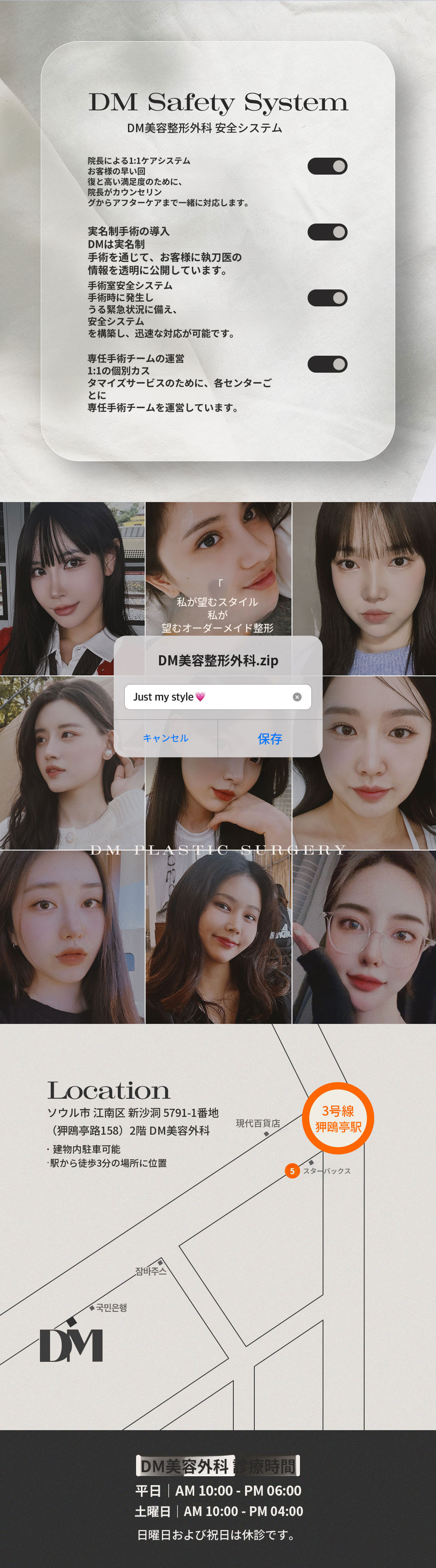 ♥最小切除上眼瞼♥