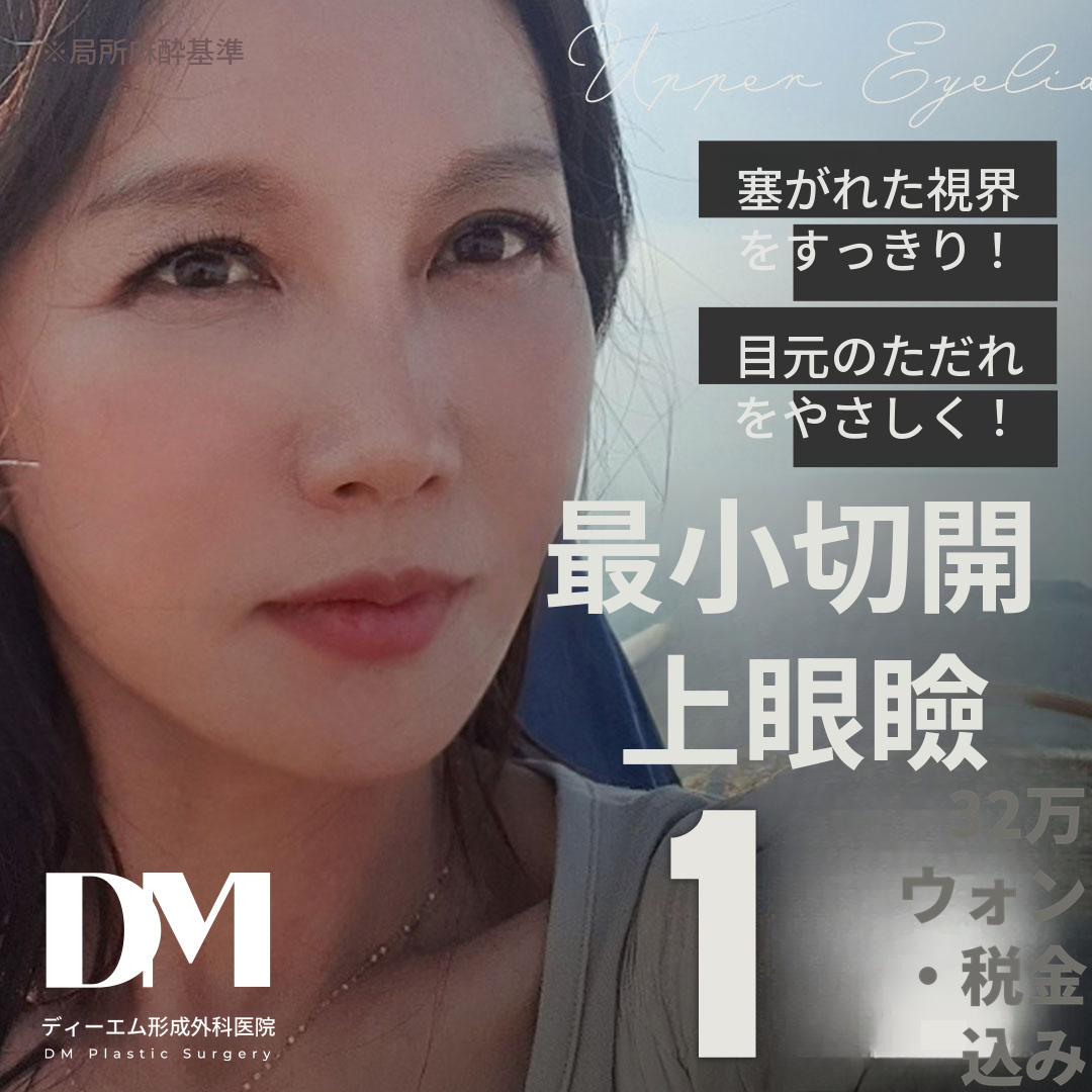 ♥最小切除上眼瞼♥