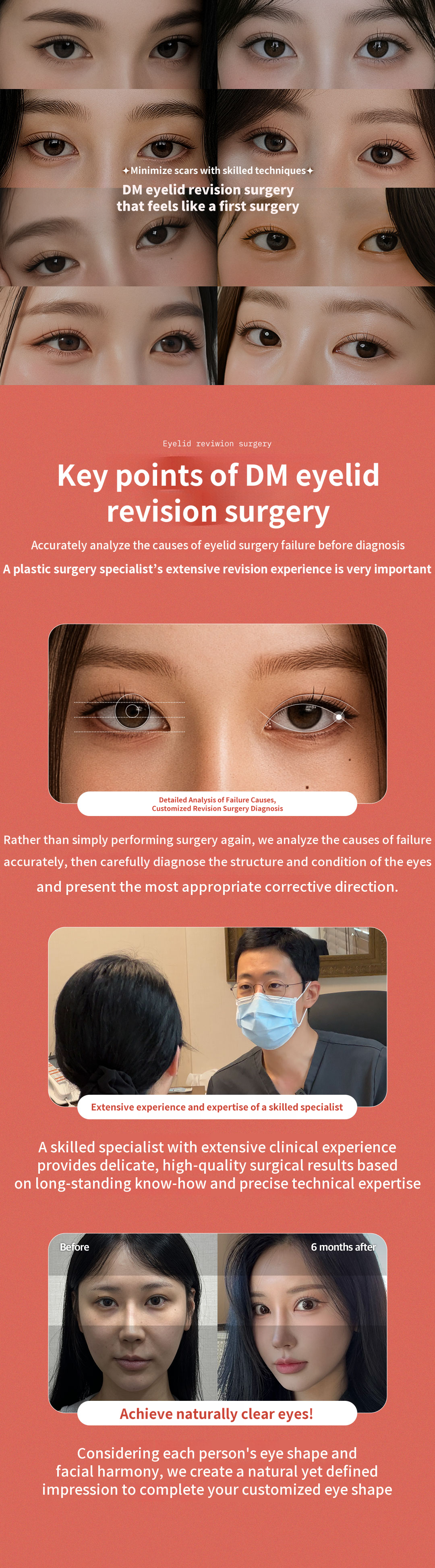 ❤DM❤ Eye Reoperation
