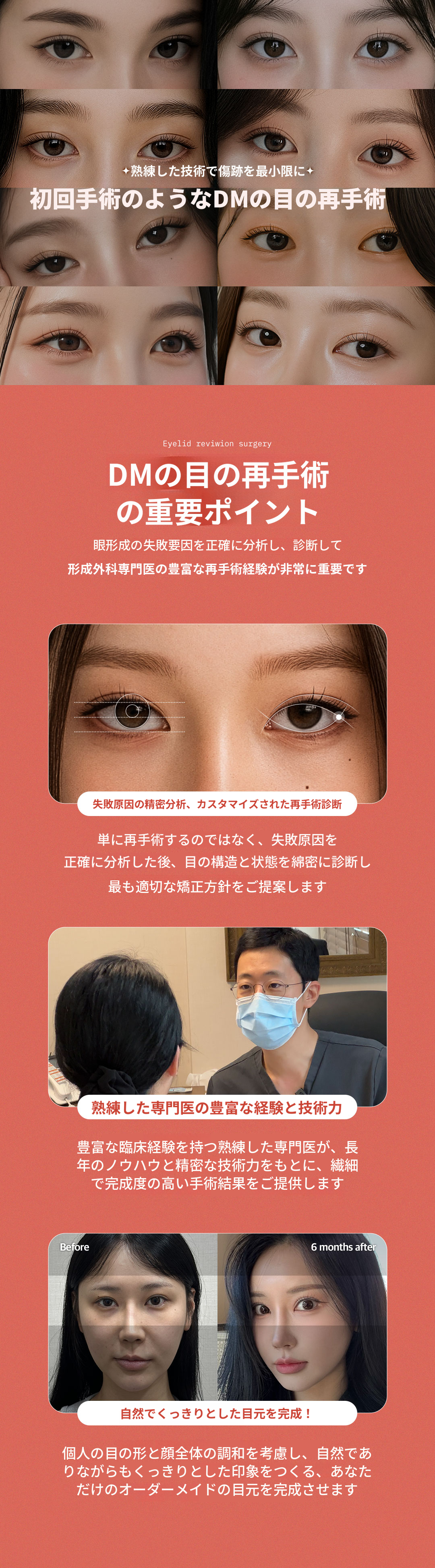 ❤DM❤ 目の再手術