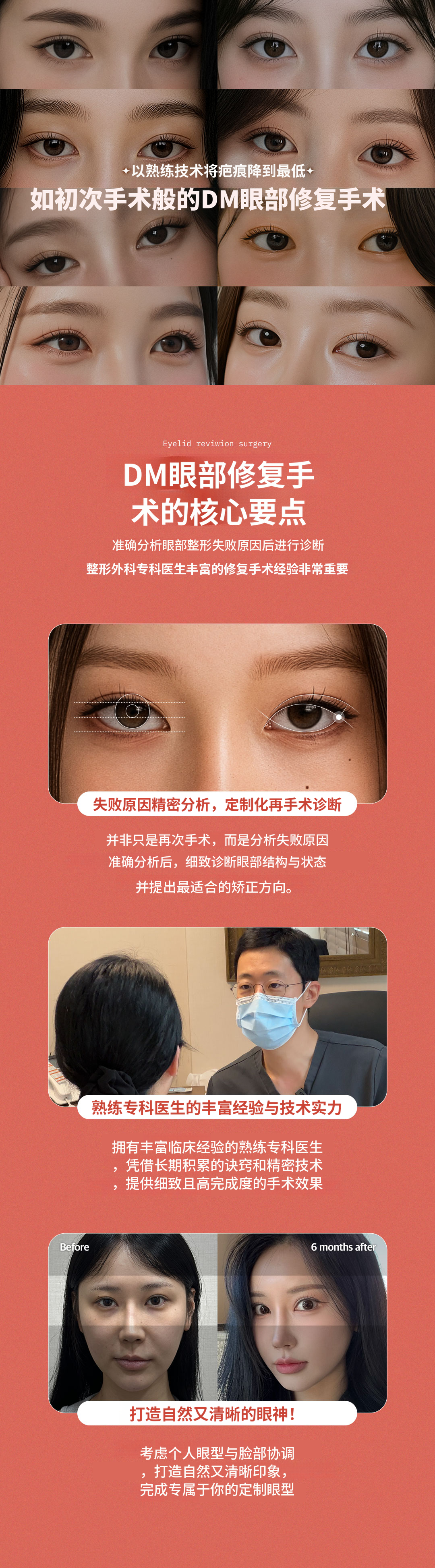❤DM❤ 眼部手术
