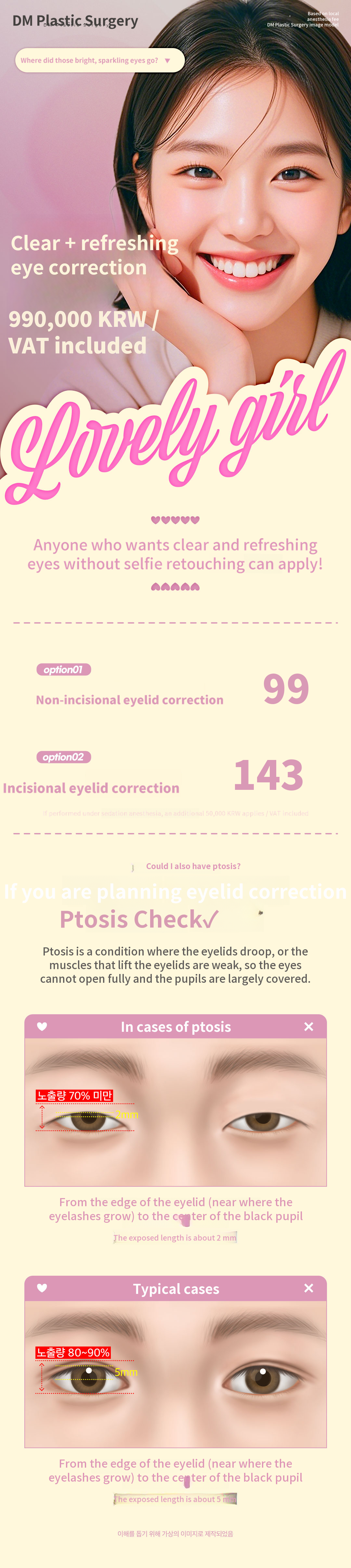 ♥DM Eyelid Correction♥