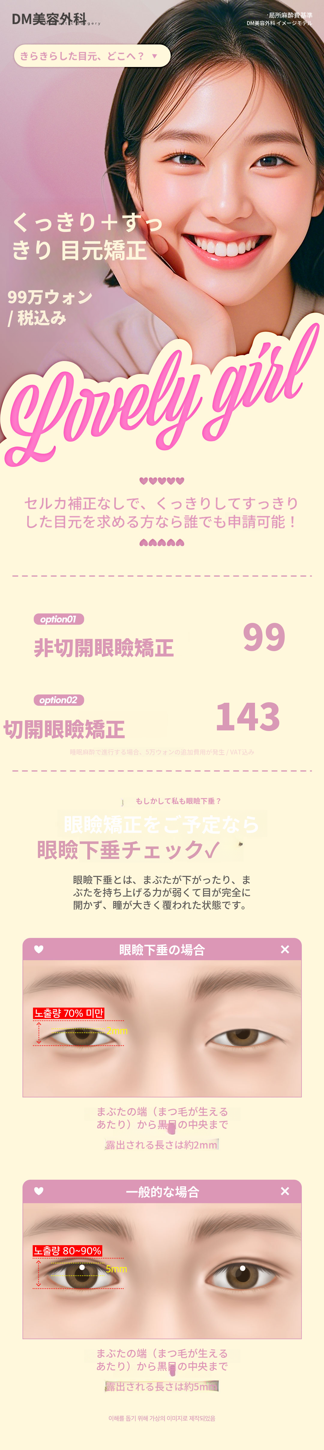 ♥DM目の形矯正♥