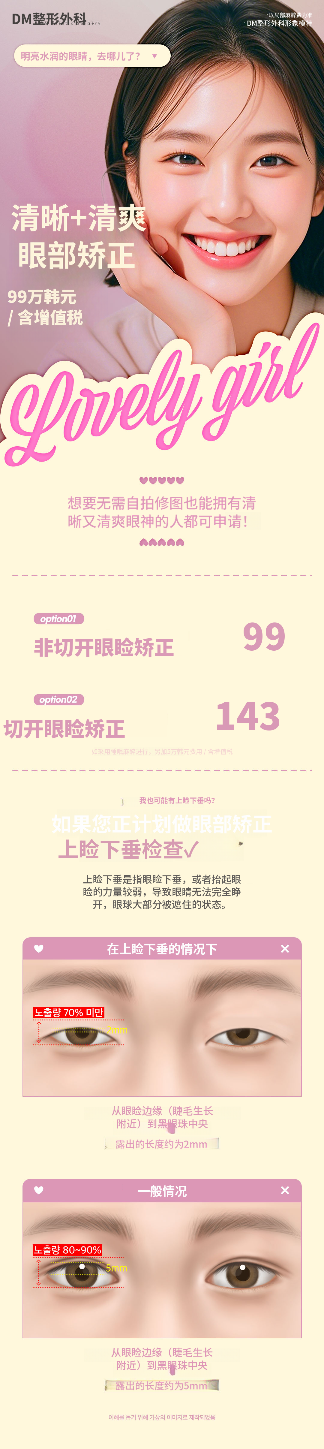 ♥DM眼形矫正♥